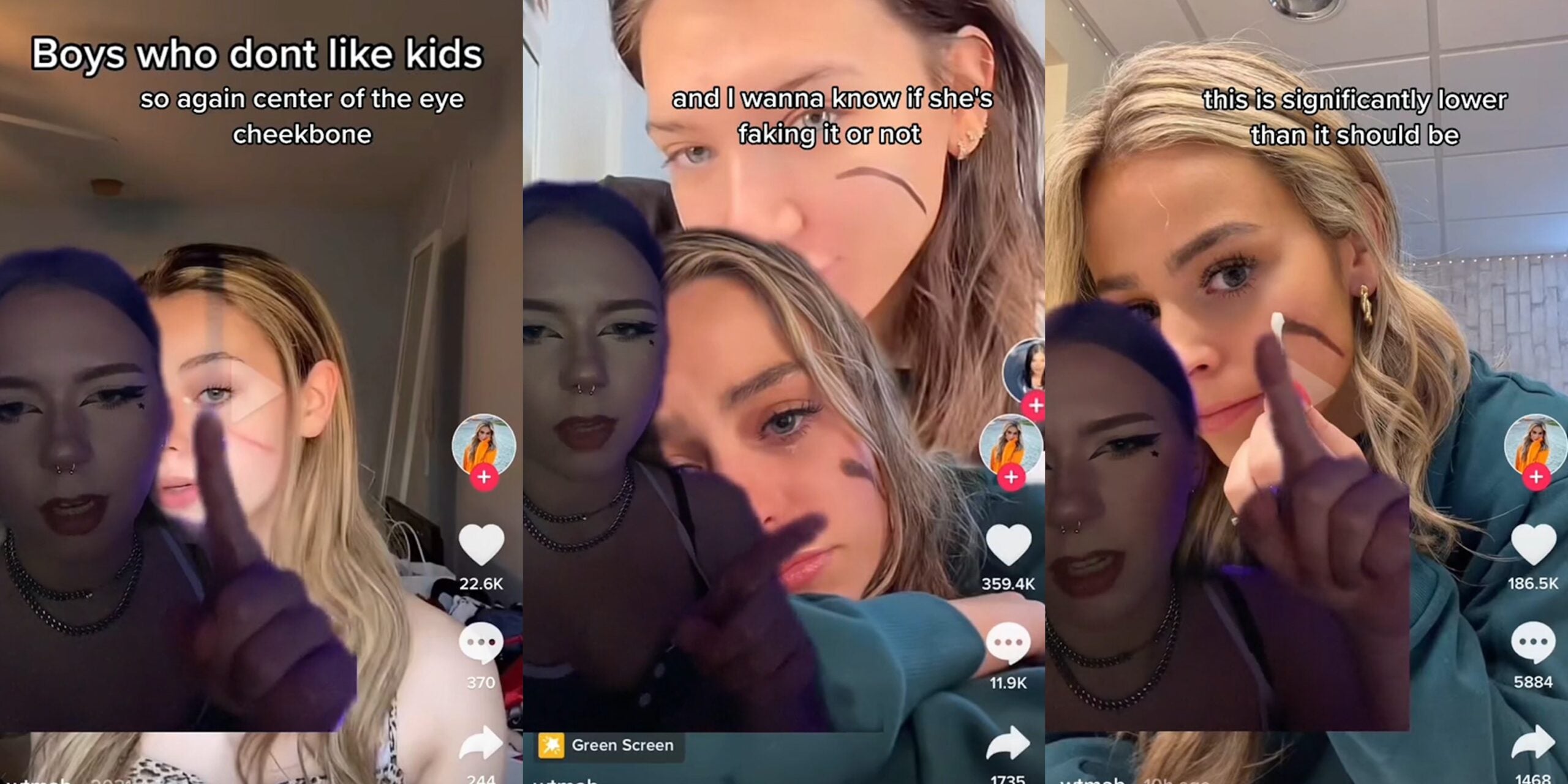 ‘It Never Fully Went Away, and Neither Did My Insecurities’: People Think Influencer Known for Facial Scar Is Faking It for Clout